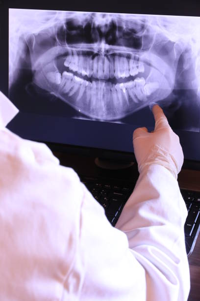 Best Emergency Denture Repair in Los Osos, CA