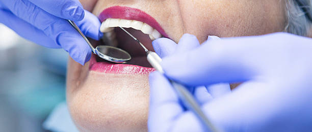 Best Emergency Root Canal Treatment in Los Osos, CA